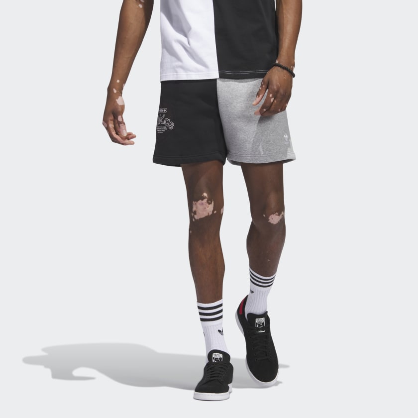adidas Blocked Fleece Shorts - Black | Men's Lifestyle | adidas US